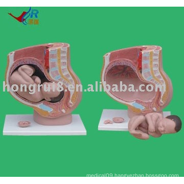 Advanced Pregnancy Pelvis Anatomy(4 parts),Female anatomy Model
